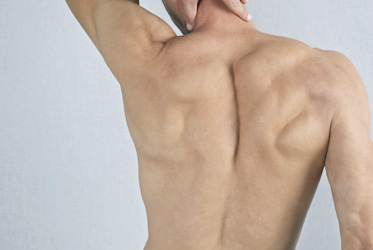 Laser Hair Removal for men's back and shoulders